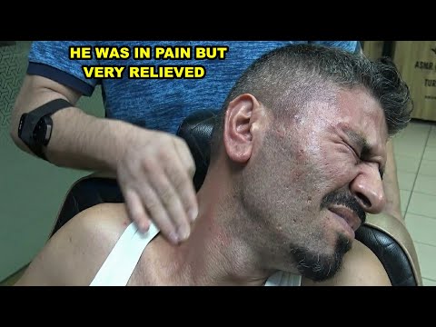 HE WAS IN PAIN BUT VERY RELIEVED + BEST CRACKS + Asmr Barber Hard Head,Face,Ear,Neck,Nose massage