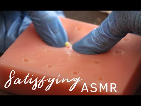 Satisfying Pimple Popping ASMR Video