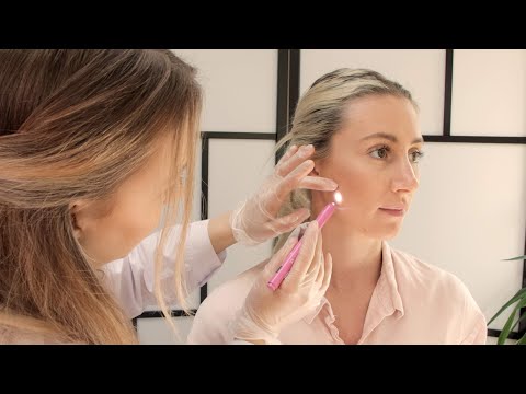 ASMR Real Person Medical Skin & Hairline Mole Inspection Exam with Skin Scraping Roleplay