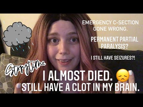 ASMR | Storytime • What It’s Like To Have A Stroke (My Experience • I Almost Died/Still In Recovery)