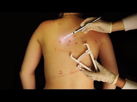 ASMR | REAL BACK INSPECTION (mapping + treatment)