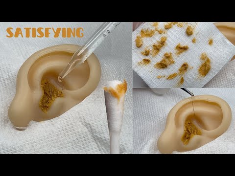 [ASMR] Deep Ear Cleaning | LOADS of Wax & Hair | Satisfying