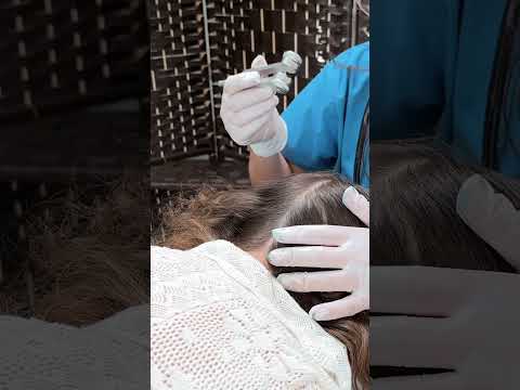 ASMR Most Relaxing Scalp Exam She Was In Heaven #asmr