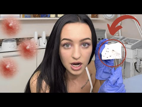 [ASMR] Blackhead Extractions & Skin Pampering RP