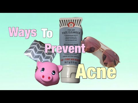 Ways to prevent ACNE!!!!😱