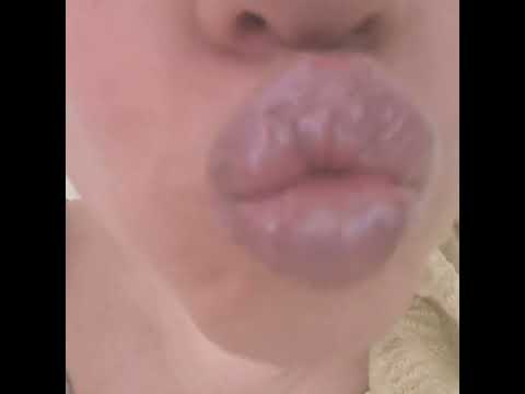 Asmr Glossy kiss