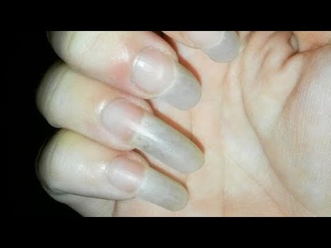 Grow Long Nails Fast(How I Grew My 1 Inch Nails)(ASMR)