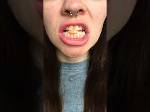 ASMR 🍊 SKITTLE smoothie tasty candy chew sugar crush teeth satisfying sunny mouth sounds #shorts