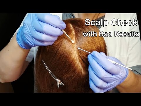 ASMR Perfectionist Medical Scalp Check with Bad Results (Whispered)
