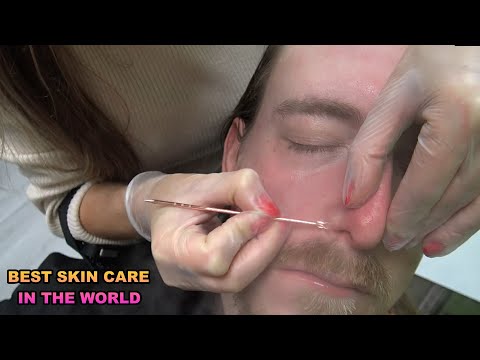 ASMR BEST FEMALE SKIN CARE IN THE WORLD & FACIAL THERAPY & face, nose, sleep massage #femaleskincare