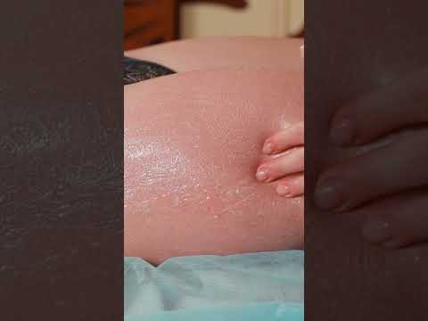 Honey fight cellulite | ASMR foot massage for Anna #cellulite #foot #shorts