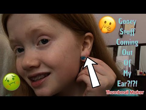 Gooey Stuff Came Out Of My Ear ?!?! 🤭🤢| Vlog