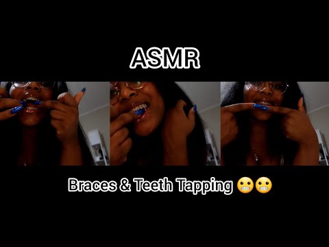 [ASMR] Up Close Braces & Teeth Tapping 🦷💅🏾