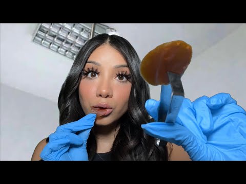 ASMR| Weird Nurse Eats Your Face 👩🏻‍⚕️🫢(mouth sounds, scab eating, personal attention) Roleplay