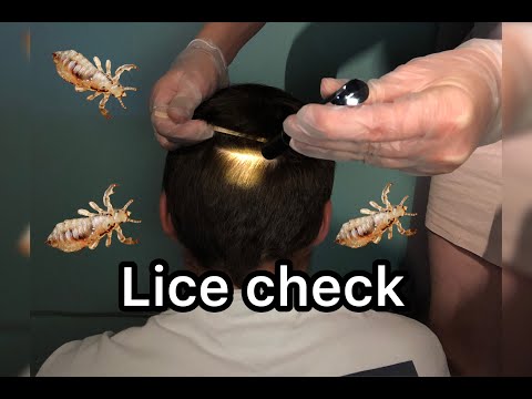 ASMR| Lice Check Real person !! (Scalp inspection)