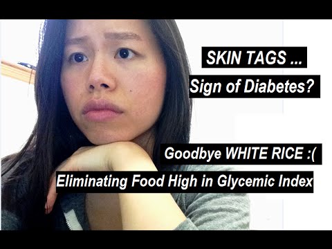 SKIN TAGS & DIABETES?! Eliminating white rice, high glycemic foods :(
