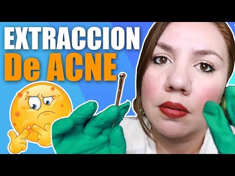 ASMR Dermatologa Examen y Extracción de ACNE RoIePIay / Murmullo Latino / ASMR Mexico