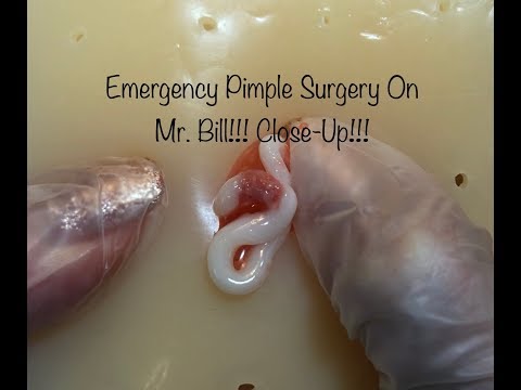 ASMR~ POPPING On Mr. Bill With Dr. Mom! CLOSE UP! SUPER SATISFYING! ENJOY! 🤪