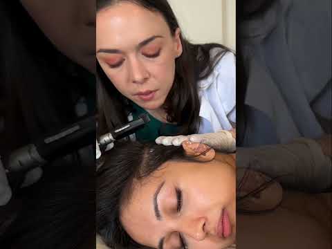 Asmr scalp #sleep #asmr #relaxing #asmrvideos #satisfying #tingles #relax #oddlysatisfying #hair