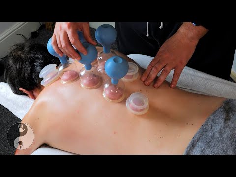 ASMR Deep Tissue Back Massage with Cupping [No Talking]