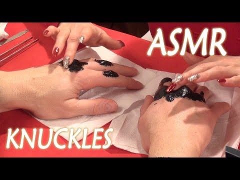 Treating Fighter Calloused Knuckles ASMR
