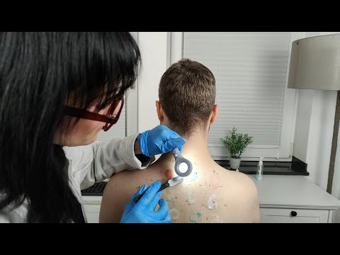 ASMR | Special & Detailed Allergy Test On The Back *(Fe)MaleASMR*