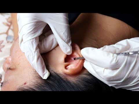 ASMR Removing Blackheads INSIDE EAR CREVICES, Ear Cleaning w. LATEX GLOVES, MY PINKY, Qtips, Massage