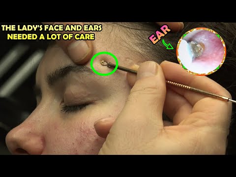 FEMALE EAR AND FACE CLEANING + SKIN CARE + HOT TOWEL + ASMR FEMALE THERAPY + BAYAN CİLT BAKIMI #asmr
