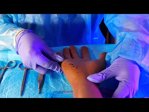 ASMR Hospital Getting Sutures in the ER | Medical Role Play