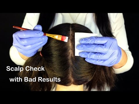 ASMR Medical Scalp Cleansing & Re-Balancing | Scalp Check with Bad Results (Whispered)