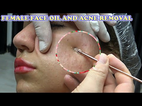ASMR FEMALE FACE OIL AND ACNE REMOVAL - HAIR WASH - MASSAGE - HOT TOWEL AND STEAM - ASMR CİLT BAKIMI