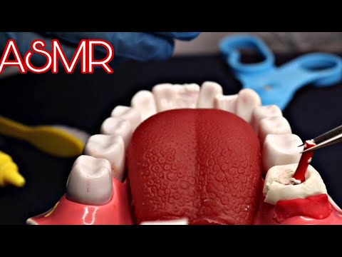 ASMR DENTISTA | TRATAMENTO DE CANAL ( roleplay realistic dentist )