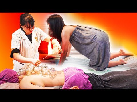 ASMR Fire Cupping Therapy 🔥 Traditional Chinese Massage for Enhanced Well-being