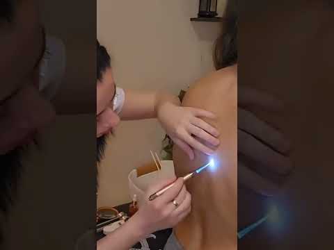 ASMR Back Inspection and Medical Exam Soft Spoken Roleplay Real Person