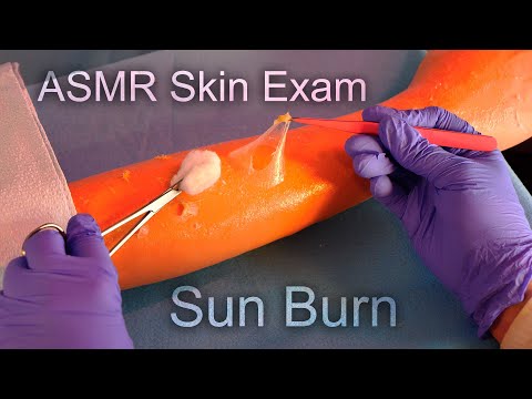 ASMR Medical Skin Exam | Taking Care of Your Sunburn