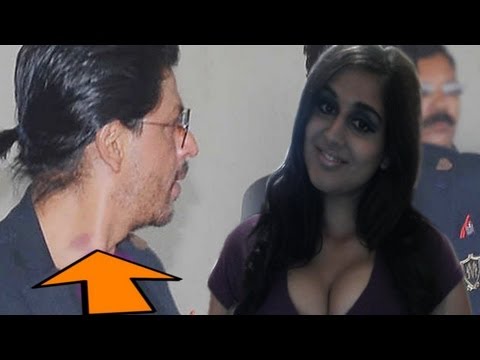 Shahrukh Khan Bollywood Actor  Hicky Mark  on His Neck - video review