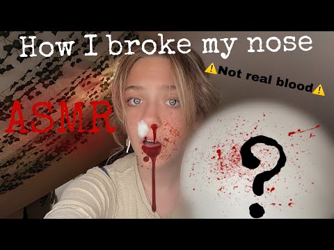 ASMR| How I broke my nose 👃🤕 Storytime w/ assorted triggers🩸NOT REAL BLOOD🩸 #asmr #storytime