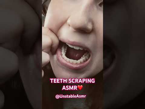 Teeth scraping + tapping FULL on  @UnstableAsmr ! Sub for more!❤️❤️ #asmrmouthsounds #asmrtapping