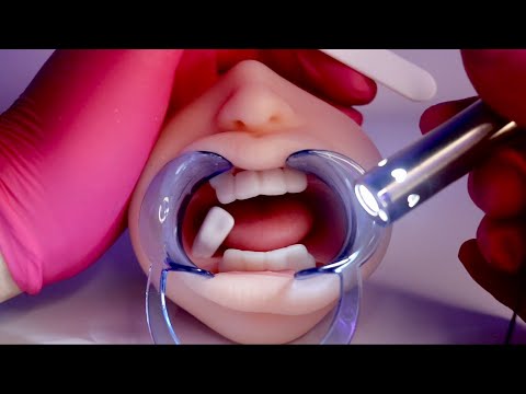 ASMR | DENTISTA 🦷 extração de dente
