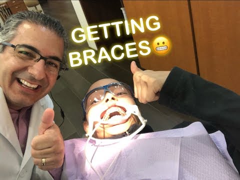 COME GET BRACES WITH ME! (VLOG)