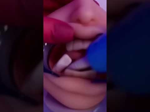 ASMR extraindo seus dentes