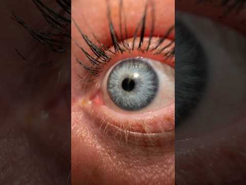 Is this the rarest eye color?! #viral #eyes #rare