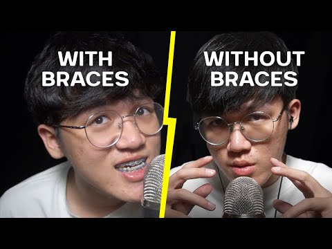 ASMR Mouth Sounds Braces Vs Without Braces