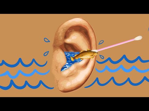 ASMR Animated Ear Cleaning (Fish Removal)