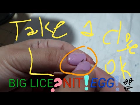 ASMR COMBING REMOVING LICE, NIT AND EGGS (TICKING SOUNDS)