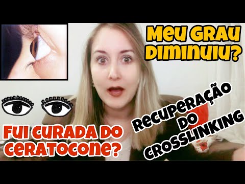 CERATOCONE - DOENÇA GRAVE NOS OLHOS (RECUPERAÇÃO CROSSLINKING) | Bianca Peres