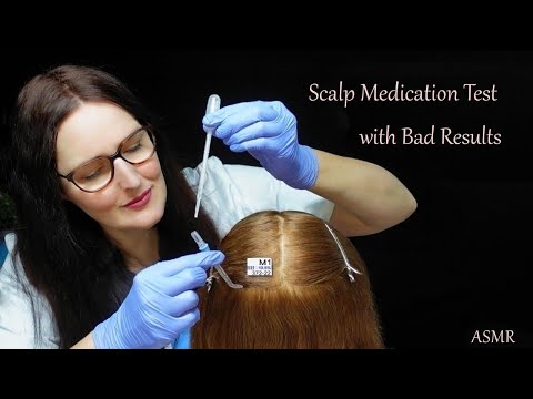 ASMR Clinical Trial: Scalp Examination & Medication Test with Bad Results