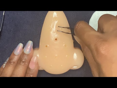 ASMR | Extremely Satisfying Pimple Popping