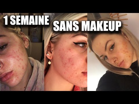 1 SEMAINE SANS MAKEUP I AUREVOIR l'acné ?
