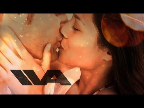 ASMR Kissing Sounds & Intense Head Massage Comforting Girlfriend Roleplay (Wet Mouth Sounds)